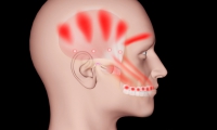 Dolor orofacial y transtornos temporomandibulares