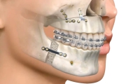 Cirugía oral y maxilofacial