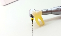 Endodoncia